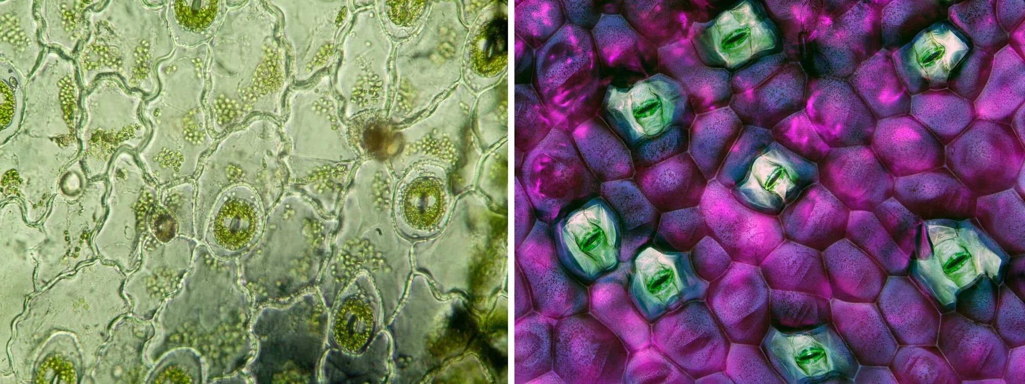 Устьица листьев микроскоп. Устьица у растений это. Устьица в микроскопе. Устьица растений под микроскопом. Кожица листа традесканции