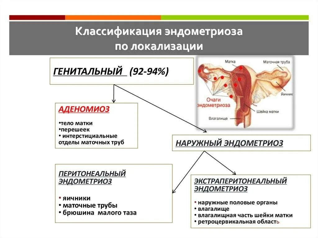 Что означает эндометриоз матки. Классификация наружного генитального эндометриоза. классификация внутреннего эндометриоза. классификация экстрагенитального эндометриоза. классификация эндометриоза по локализации.