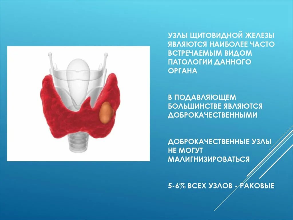 Узловые образования обеих долей щитовидной железы. Узелел щитовидной железы. Узлы в щитовидной железе. Узлы ВЩ итов дной железе.