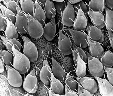 Giardia лямблия