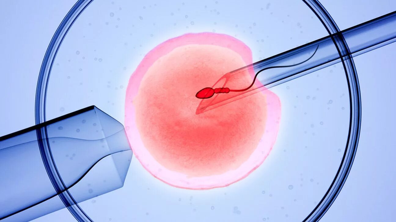 Эко экстракорпоральное оплодотворение. Экстракорпоральное оплодотворение IVF. Оплодотворение ин Витро. Оплодотворение яйцеклетки в пробирке.