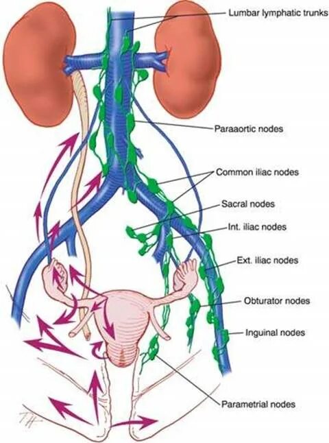 Лимфатическая система мочеточника. Лимфатическая система матки. Парааортальные лимфоузлы. Лимфоотток мочеточника. Подвздошная лимфаденопатия