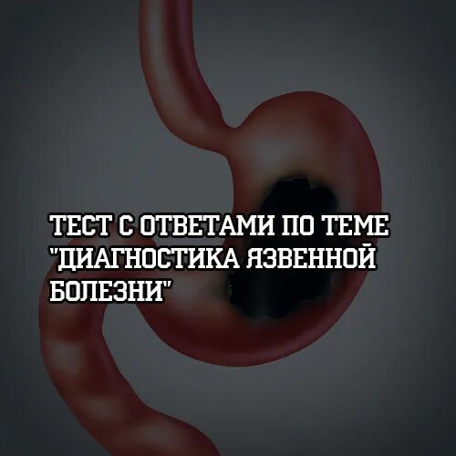 Тесты при язвенной болезни. Диагностика язвенной болезни тест. Язвенная болезнь желудка тест с ответами. Болезнь это тест ответы