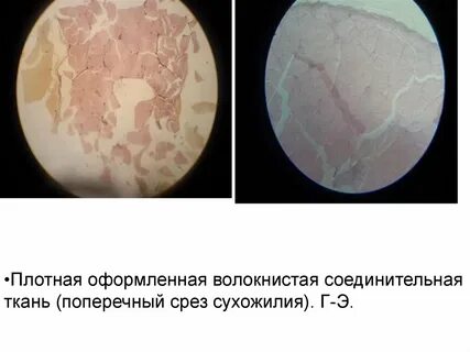 Перитеноний