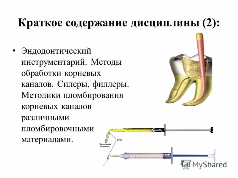 Методы пломбирования корневых