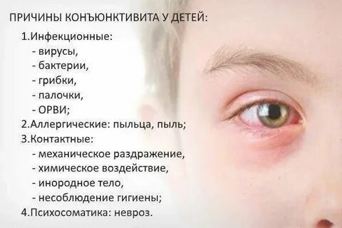 Гулять при конъюнктивите