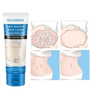 Anti stretch marks cream