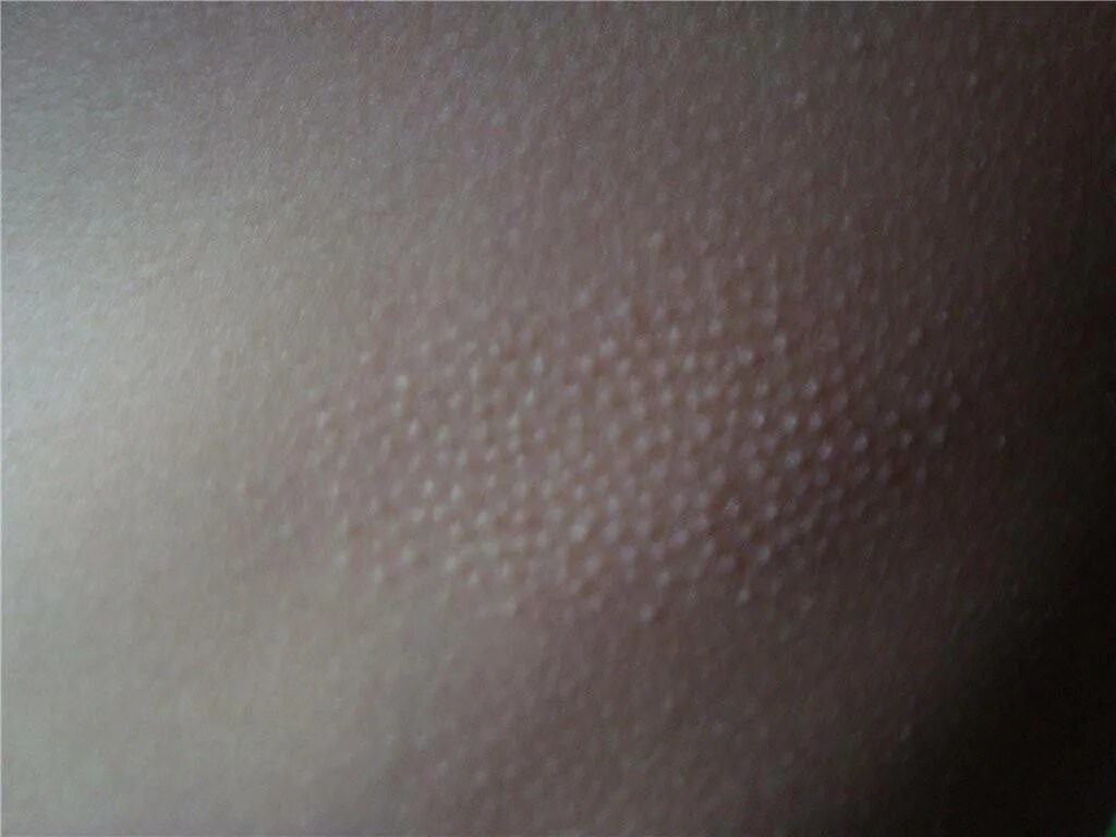 Плотный заметить