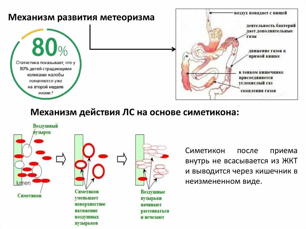 Вздутие живота диагноз. Механизм развития метеоризма. Симетикон механизм действия. Профилактика метеоризма у детей. Механизм действия симитекон.