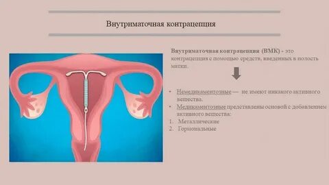 Со скольки лет можно ставить спираль