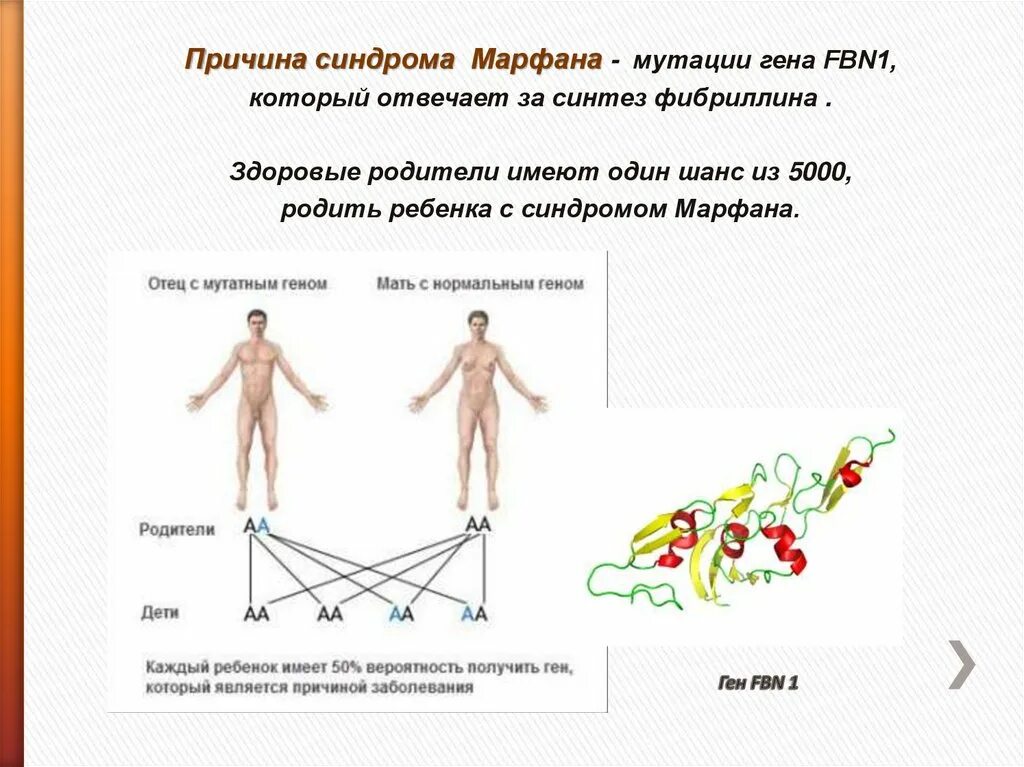 Гены детей от первого мужчины. Определите Тип наследования синдрома Марфана. Синдром Марфана опорно двигательный аппарат. Клинические проявления болезни синдром Марфана. Генные заболевания синдром Марфана.