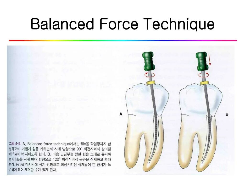 Technical forces