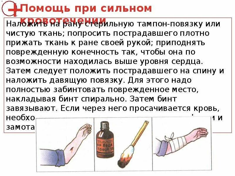 Пострадавшему с сильным наружным кровотечением. Кровотечение первая помощь. Первая помощь при кровотечениях. Первая помощь при кровотечениях презентация.