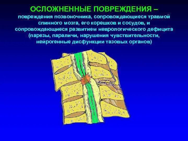 Сотрясение спинного. Неосложненные переломы позвоночника травматология. Повреждение позвоночника и спинного мозга. Осложненные повреждения позвоночника. Повреждения позвоночника, осложненные травмой спинного мозга.