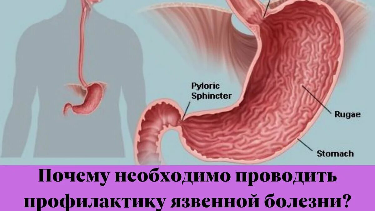 В желудке имеются