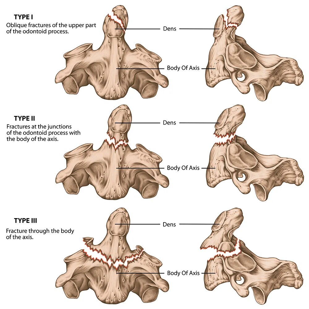 Dens axis