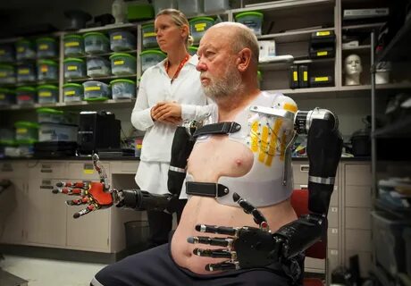 Npcs with robotic limbs