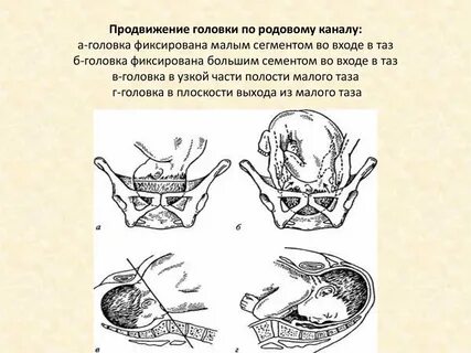 Малый сегмент головки плода