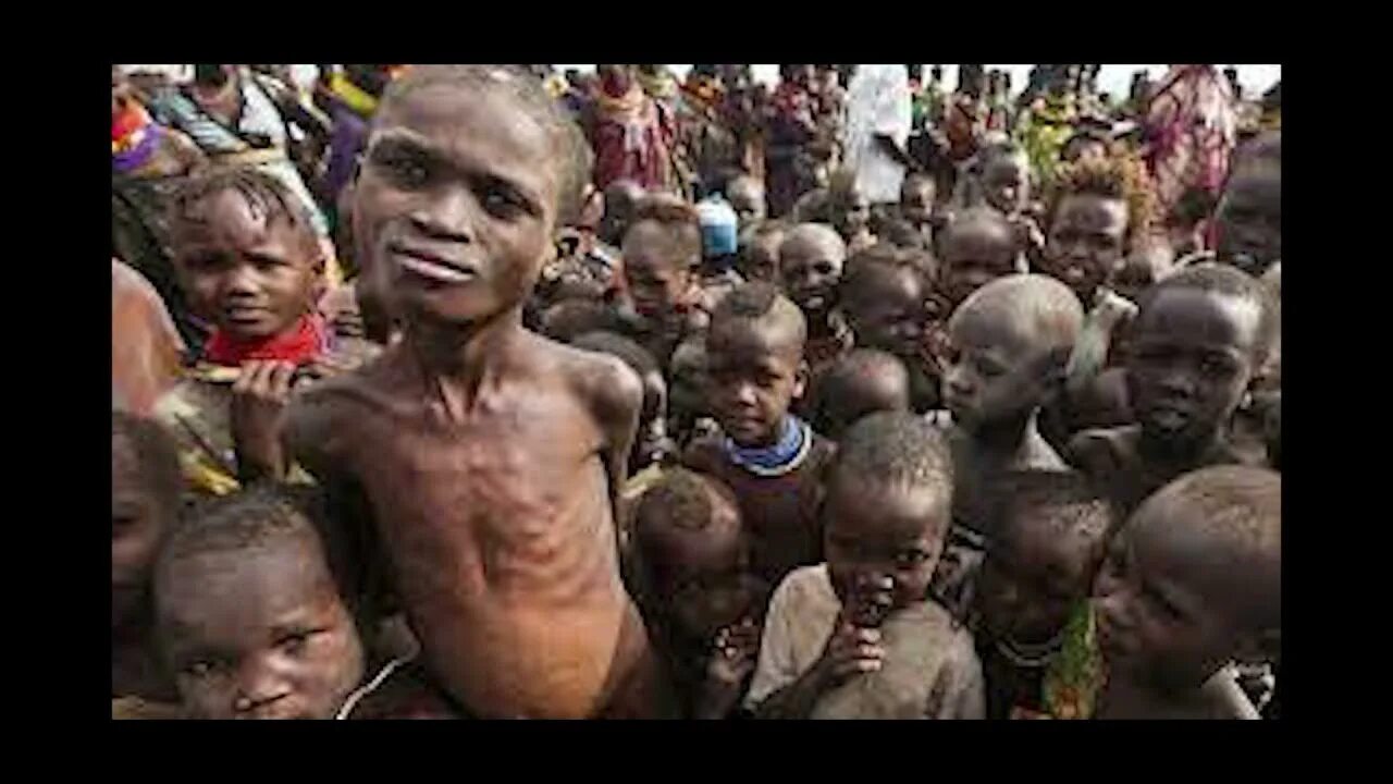 Starving people