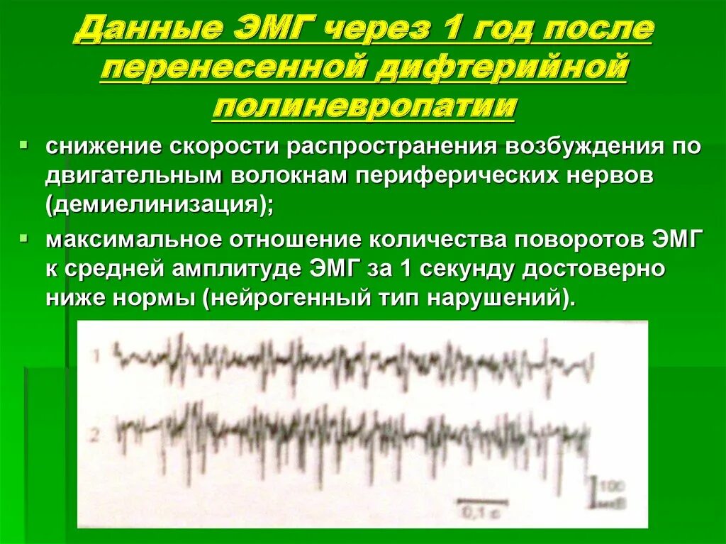 ЭМГ снижение амплитуды. Электромиография. Электромиография презентация. Амплитуда ЭМГ.