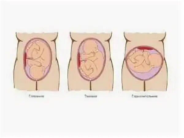 как лежит ребенок на 30. ребёнок 30 неделя беременности в утробе. расположение плода на 30 неделе беременности. положение ребенка на 35 неделе беременности. матка на 39 неделе беременности.