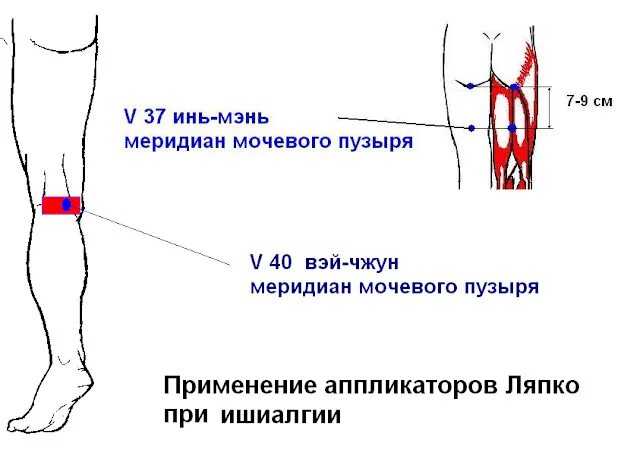 Артерии подколенной ямки. Артерия под коленом. Пульсация артерий стопы
