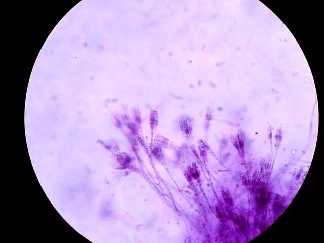 Пеницилл под микроскопом. Penicillium sp микроскоп 640. пенициллин микроскопия.