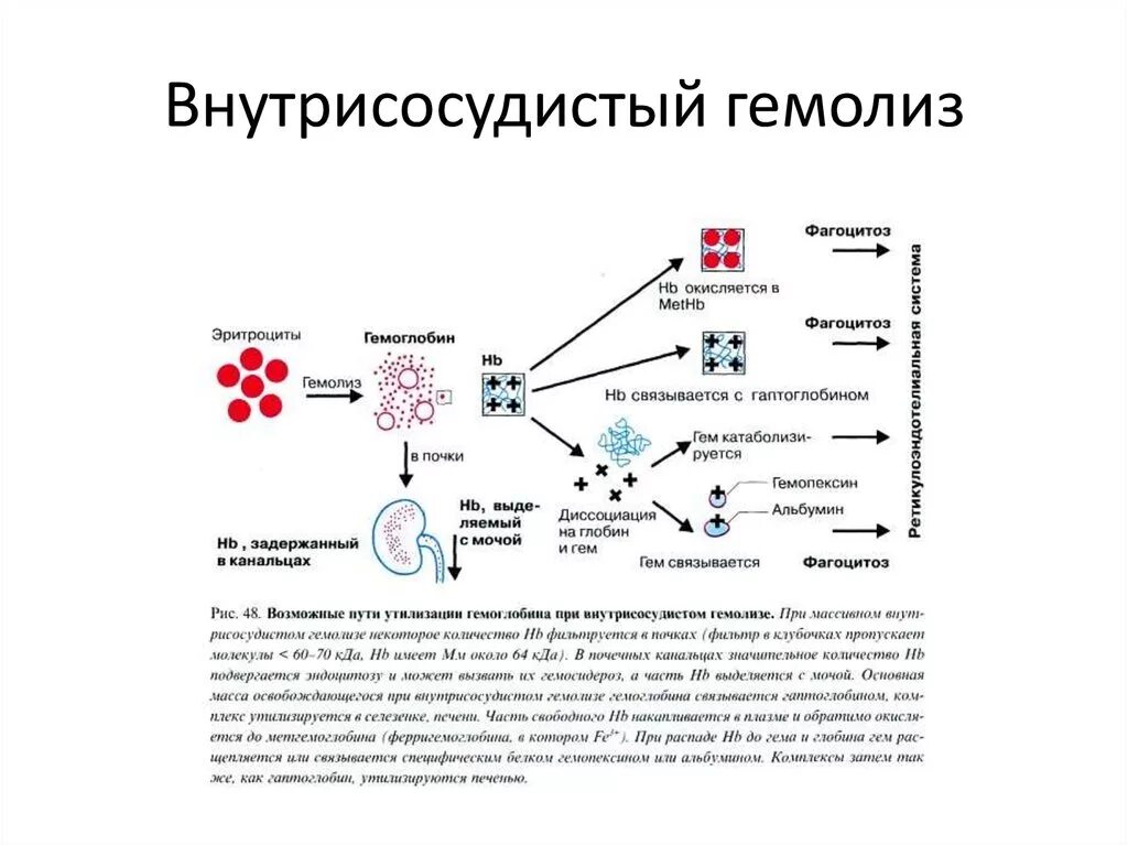 Механизмы внутрисосудистого и внутриклеточного гемолиза. Механизм гемолиза эритроцитов схема. Гемолиз эритроцитов схема. Причины повышенного гемолиза эритроцитов.