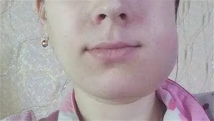 Щека ли
