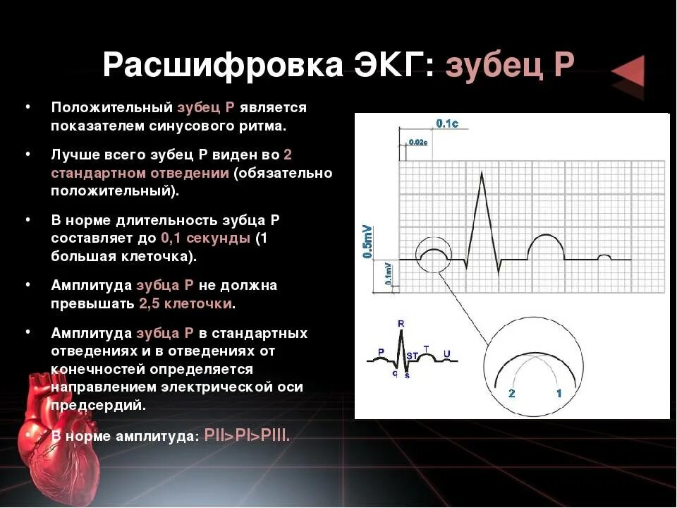 Кардиограмма в норме показатели ЭКГ. Кардиограмма сердца расшифровка норма и патология. ЭКГ 2 отведение норма. Что такое PQ В кардиограмме сердца норма.
