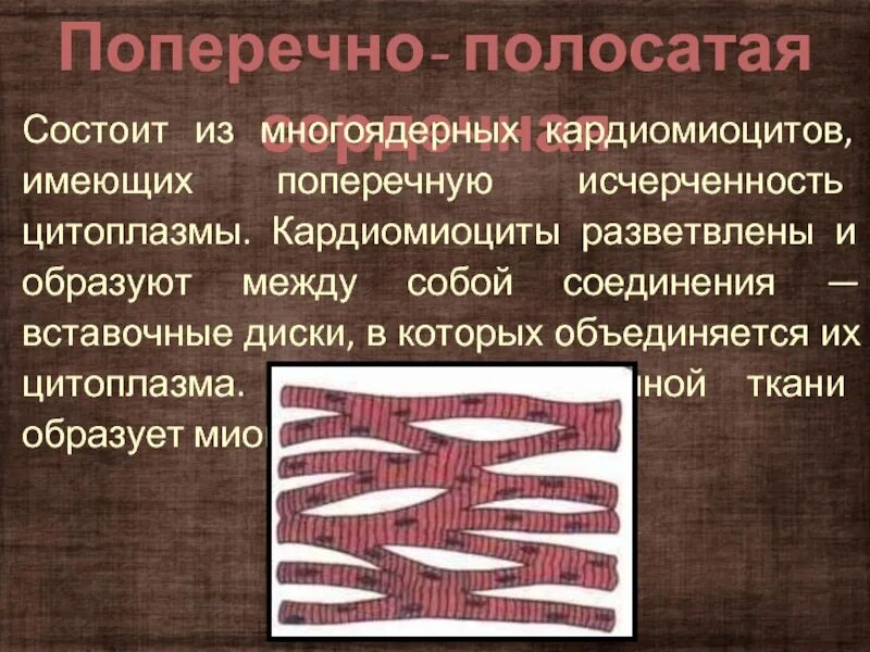 Состоит из клеток имеющих поперечную исчерченность. Поперечно полосатая исчерченность. Поперечно-полосатая исчерченность кардиомиоцитов. Поперечная исчерченность. Поперечная исчерченность кардиомиоцитов.