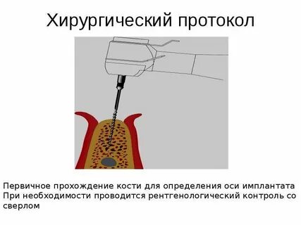 Операционный протокол
