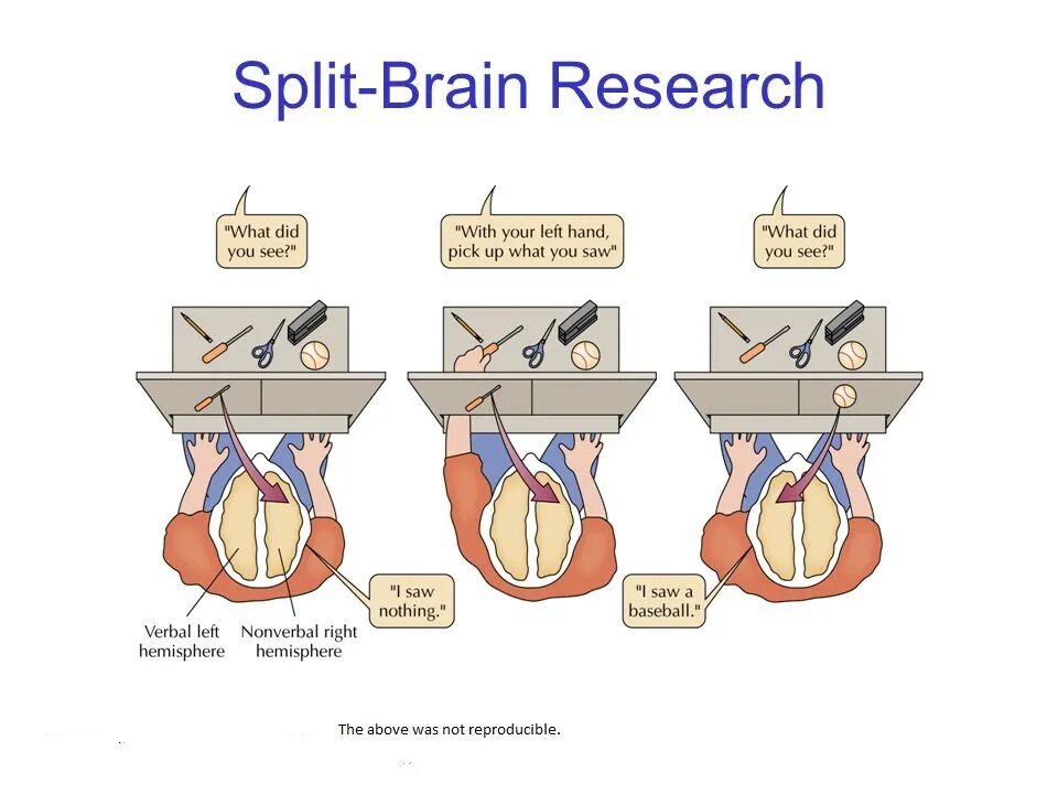 Split brain. Эксперимент Сперри. Газзанига расщепленный мозг. Эксперимент Сперри и Газзанига.