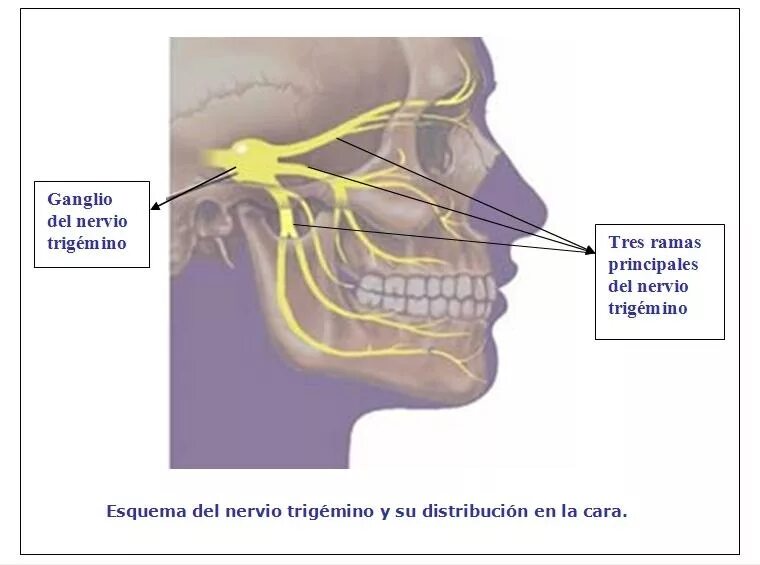 Невралгия тройничного нерва нижней челюсти. Невралгия тройничного нерва схема. Тройничный нерв в челюсти. Блокада тройничного нерва. Можно греть тройничный нерв
