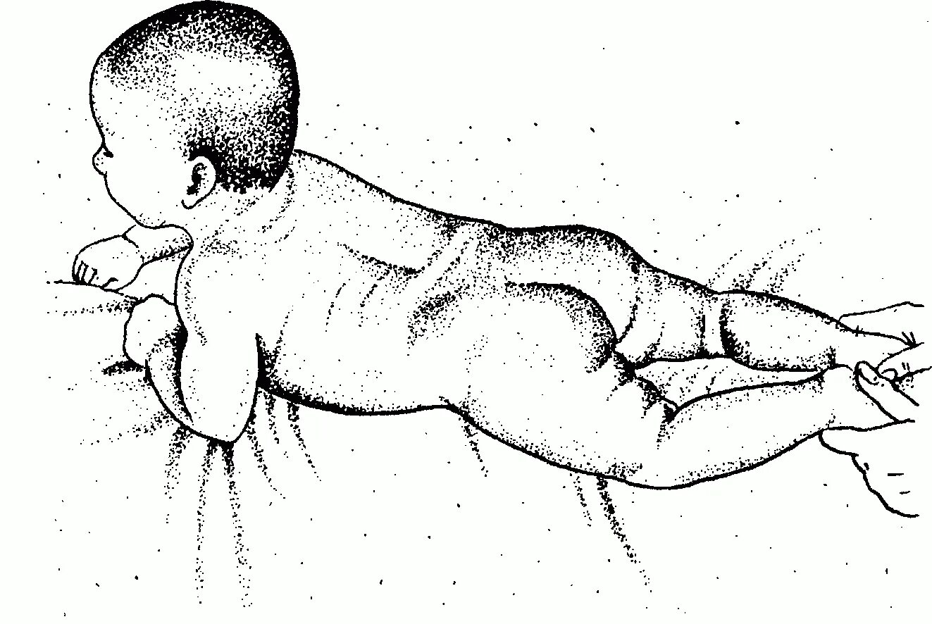 Рефлекс упражнение. Рефлекс ползания Бауэра у новорожденных. Рефлекс ползания (Бауэра) и спонтанное ползание. Массаж ребенка рефлекторное ползание. Рефлекторное ползание ребенка 3 месяца.