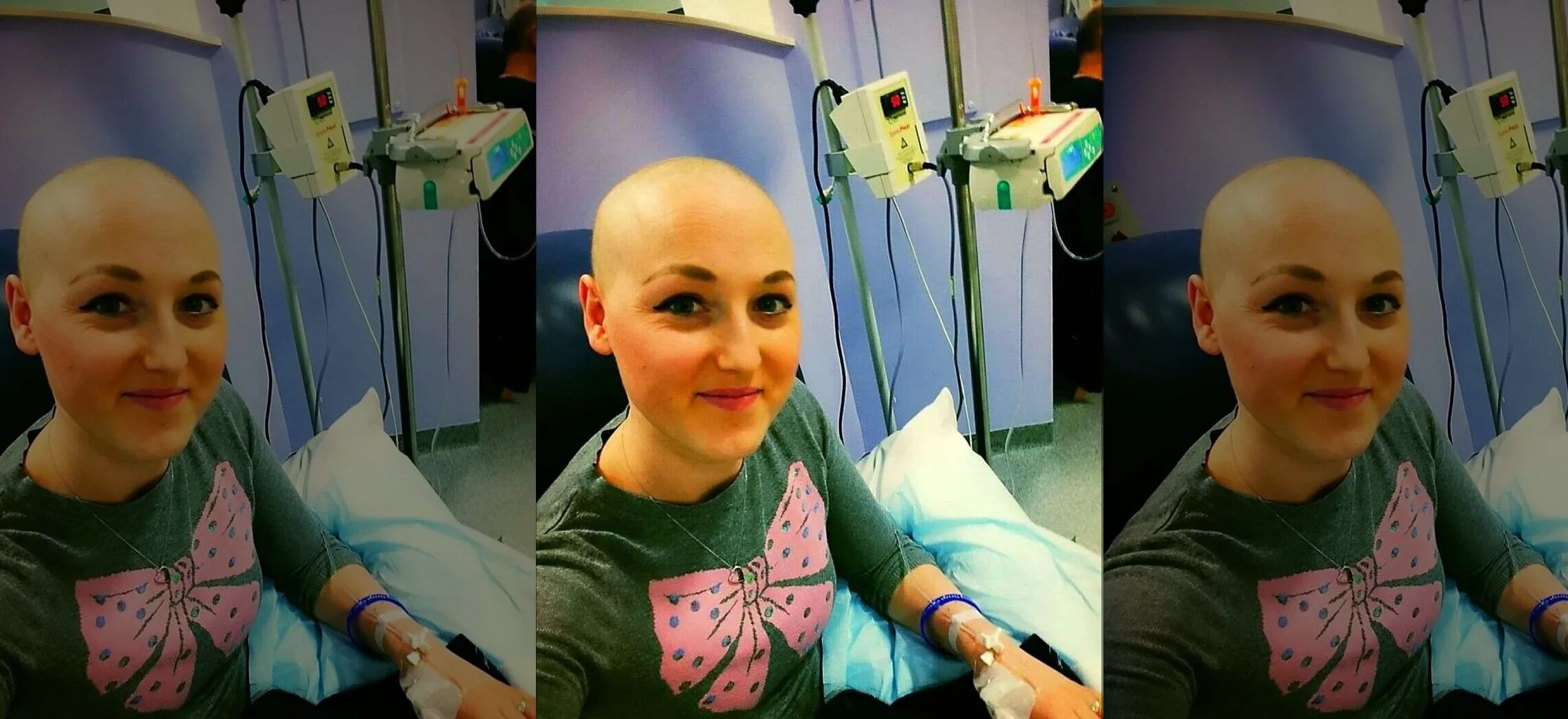 Короткие стрижки после химиотерапии. Волосы после химиотерапии. Волосы после онкологии
