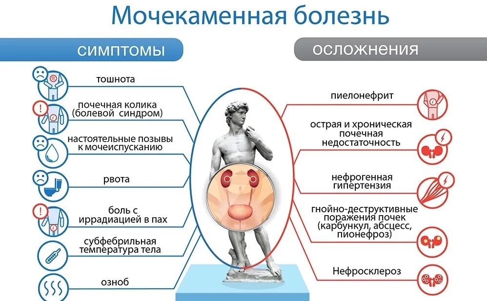 Заболевания связанные с почками. Мочекаменная болезнь симптомы. Камни в почках симптомы у женщин. Психосоматика мочекаменной болезни у женщин. Профилактика мочекаменной болезни.