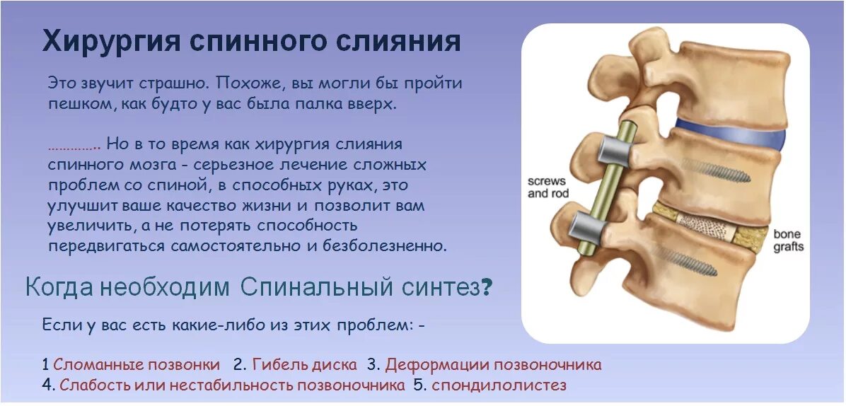 Спинальная нестабильность что это. Нестабильность поясничного отдела позвоночника. Нестабильный поясничный позвонок. Спондилолистез. Спондилолистез и нестабильность.