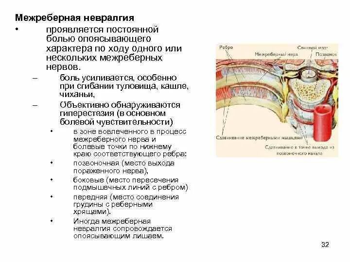 Неврология межреберная невралгия. Невралгия межреберная с левой стороны симптомы. Невралгия меж рёберная симптомы. Чем снять межреберную невралгию