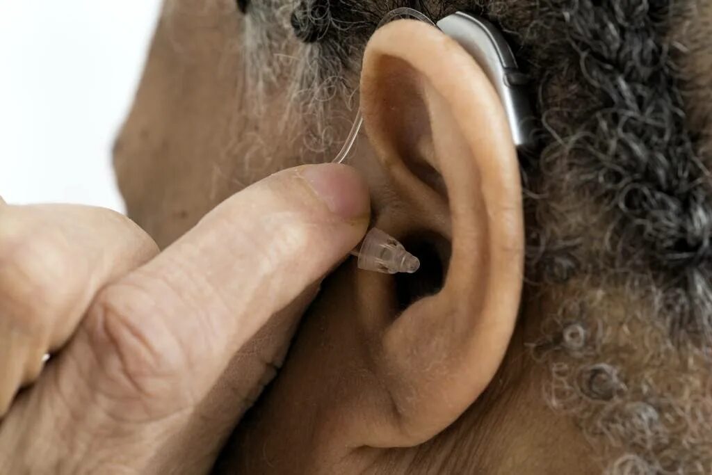 Как подобрать слуховой аппарат без врача. Слуховые аппараты для пожилых людей. Первый слуховой аппарат. Слуховой аппарат для пенсионеров. Старик со слуховым аппаратом.