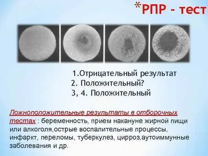 Рпр