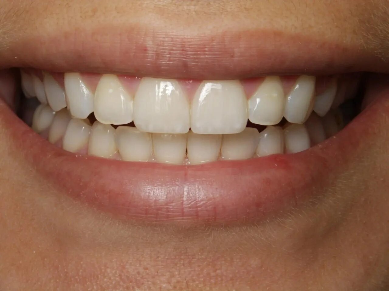 Красивые зубы. Идеальные зубы. Красивые ровные зубы.