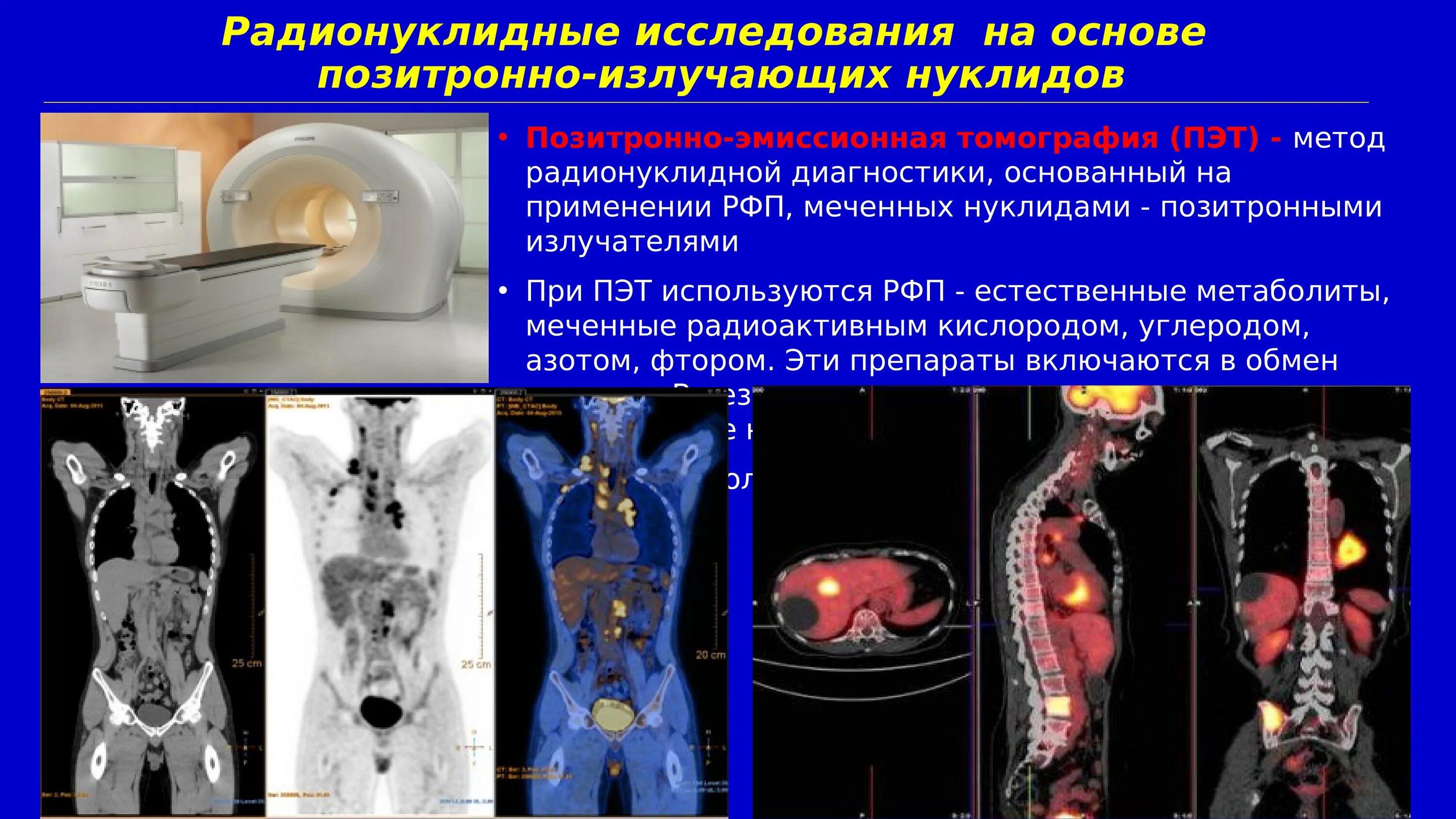 Позитронно-эмиссионная томография (ПЭТ). ПЭТ кт костей онкология. ПЭТ лучевая диагностика. Рфп при пэт кт