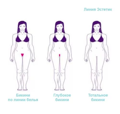 Чем отличается бикини от тотального бикини. Тотальная эпиляция зоны бикини. зона тотального бикини. зона классического бикини. глубокое и тотальное бикини.