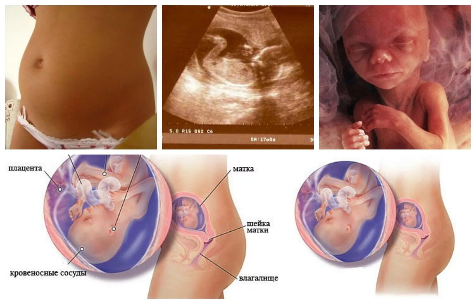 Размер малыша на 17 неделе беременности. Ребенок в животе на 17 неделе беременности. Плод ребенка на 17 неделе беременности. 16-17 Недель беременности.