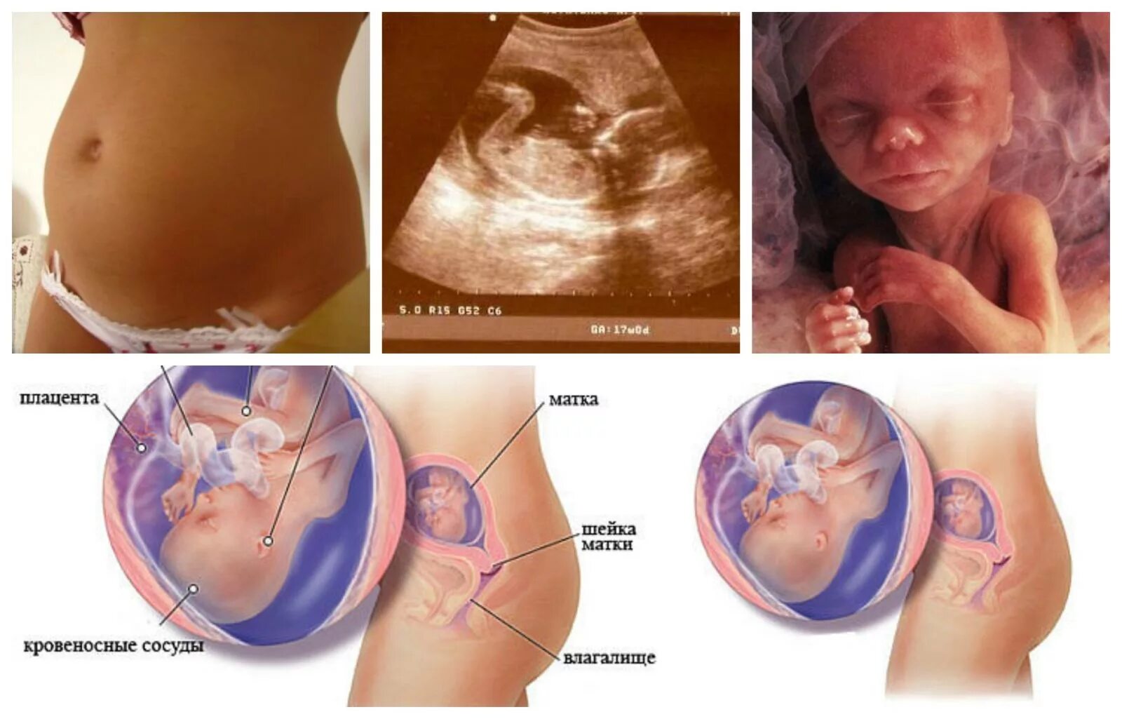 16 недель 3 5. 17 Недель беременности. Плод на 17 неделе беременности. Ребёнок на 17 неделе беременности.