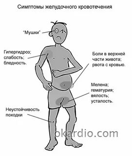 Живот при кишечном кровотечении