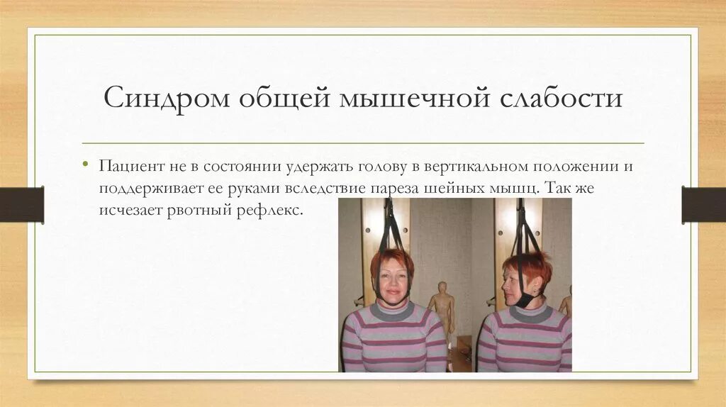 Синдром скользящего. Синдром общей мышечной слабости. синдром общей слабости синдром. синдром мышечной скованности.