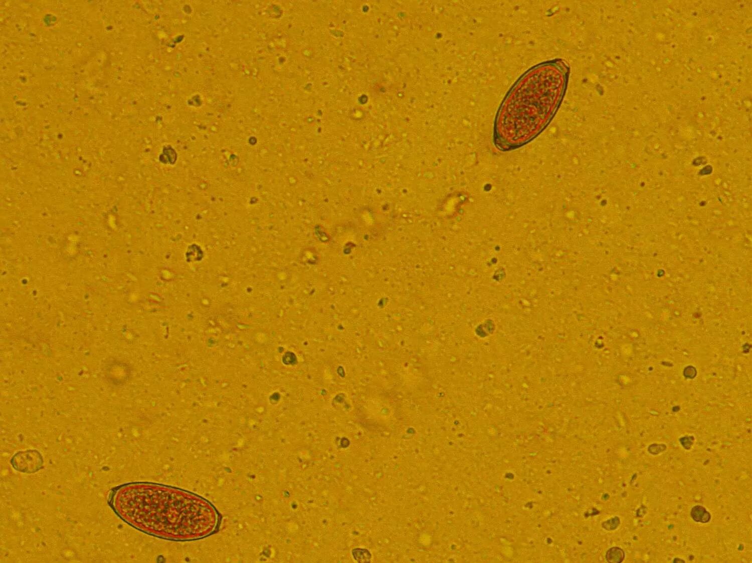 Capillaria aerophila. Острицы в Кале под микроскопом. Яйца глистов под микроскопом. Купить яйца глист