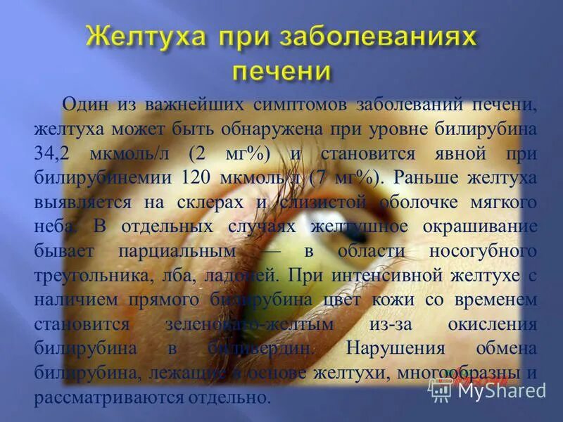 Признаки больной печени у женщин какие симптомы. Желтуха при заболеваниях печени. видмжелтухи прт поржаении печени. печеночный запах изо рта. желтухас при болезни пече.